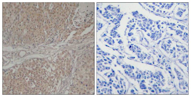 Polyclonal Antibody to Smad3 (Ab-208)