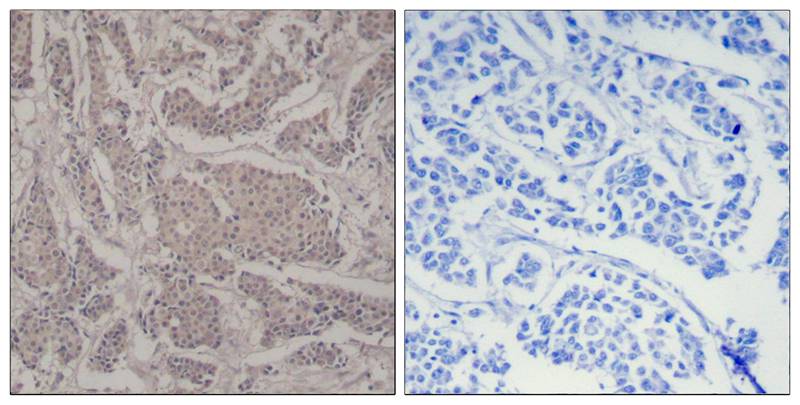 Polyclonal Antibody to Smad3 (Ab-425)