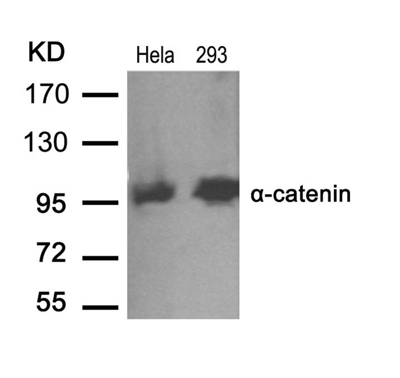 Polyclonal Antibody to  Alpha-catenin (Ab-641)