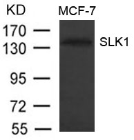 Polyclonal Antibody to SLK1