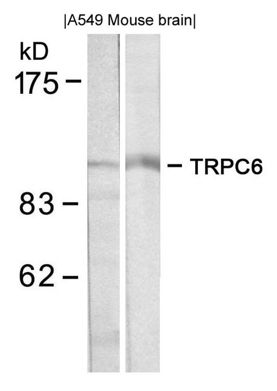 Polyclonal Antibody to TRPC6