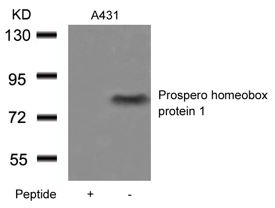 Polyclonal Antibody to Prospero homeobox protein 1