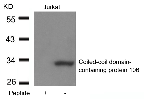 Polyclonal Antibody to Coiled-coil domain-containing protein 106