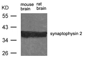 Polyclonal Antibody to synaptophysin 2