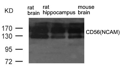 Polyclonal Antibody to CD56(NCAM)