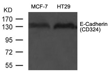 Polyclonal Antibody to E-Cadherin(CD324)