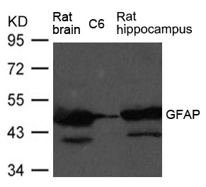 Polyclonal Antibody to GFAP