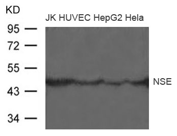 Polyclonal Antibody to NSE