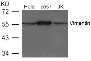 Polyclonal Antibody to Vimentin