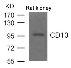 Polyclonal Antibody to CD10