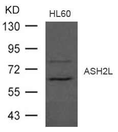 Polyclonal Antibody to ASH2L