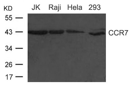 Polyclonal Antibody to CCR7(CD197)