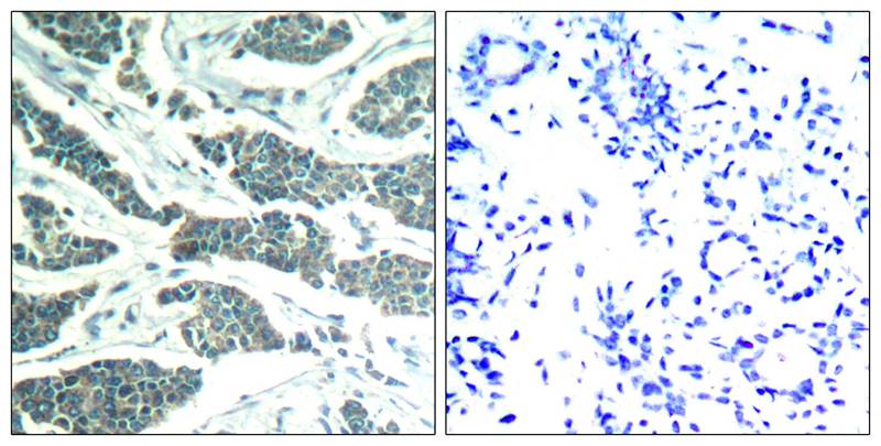 Polyclonal Antibody to AKT1/AKT2/AKT3 (Ab-315/316/312)