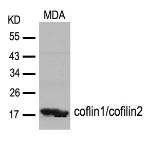 Polyclonal Antibody to coflin1/cofilin2 (Ab-88)