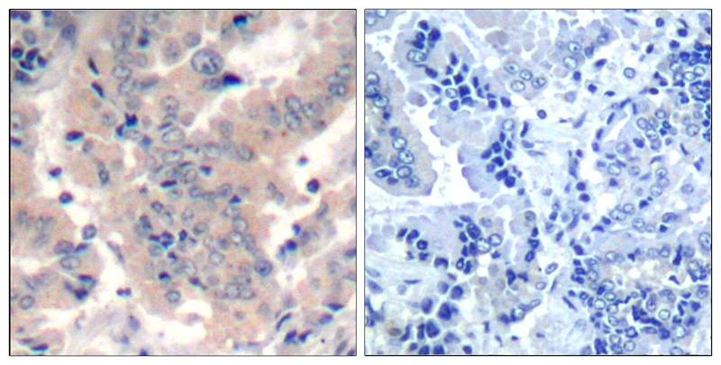 Polyclonal Antibody to PI3 Kinase p85/p55(Ab-467/199)