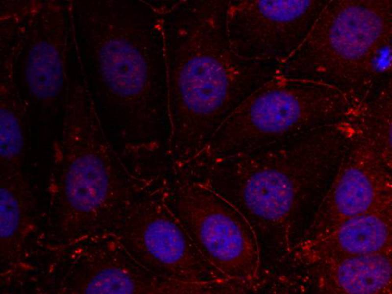 Polyclonal Antibody to Her3/ErbB3 (Ab-1289)