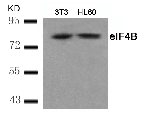 Polyclonal Antibody to eIF4B (Ab-422)