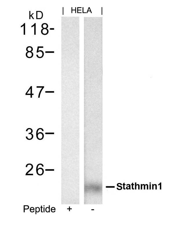 Polyclonal Antibody to stathmin1 (Ab-62)