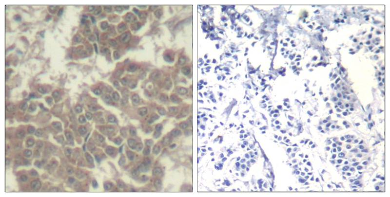 Polyclonal Antibody to Jak2 (Ab-570)