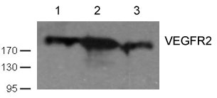 Polyclonal Antibody to VEGFR2 (Ab-1059)