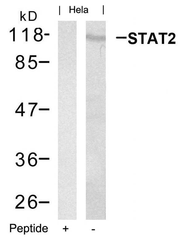 Polyclonal Antibody to STAT2 (Ab-690)