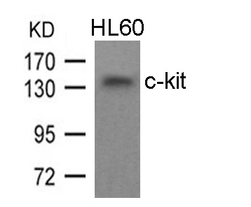 Polyclonal Antibody to c-kit (Ab-936)