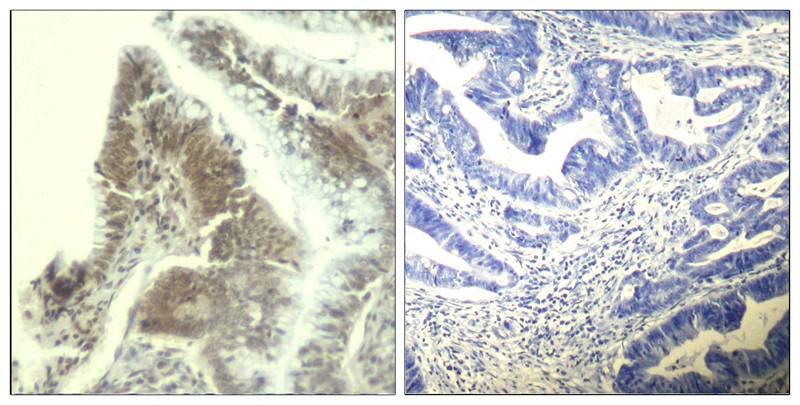 Polyclonal Antibody to CDK6 (Ab-13)