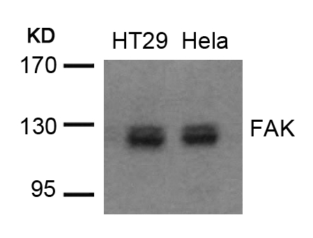 Polyclonal Antibody to FAK (Ab-576/577)