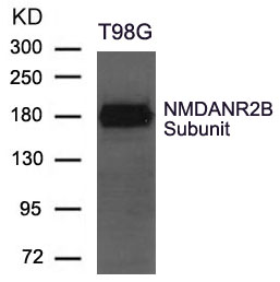 Polyclonal Antibody to NMDANR2B Subunit