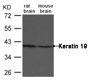 Polyclonal Antibody to Keratin 19