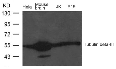 Polyclonal Antibody to Tubulin beta-III