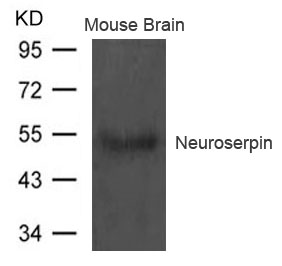 Polyclonal Antibody to Neuroserpin