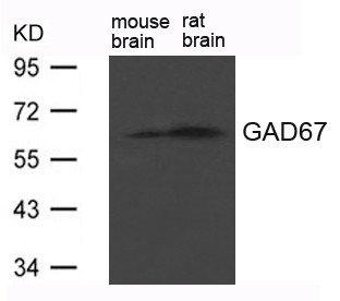 Polyclonal Antibody to GAD67(GAD1)