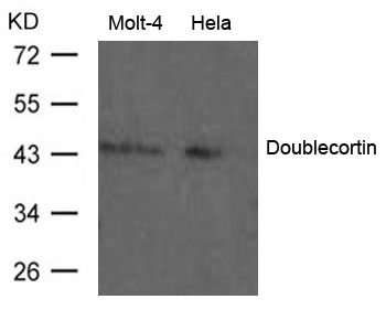 Polyclonal Antibody to Doublecortin