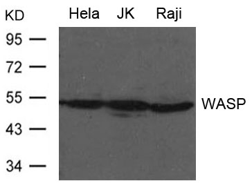 Polyclonal Antibody to WASP