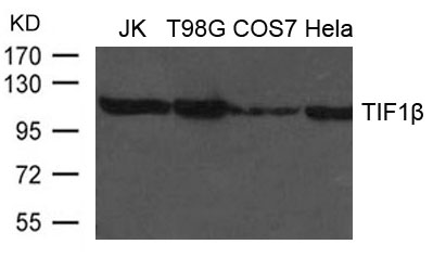 Polyclonal Antibody to TIF1beta