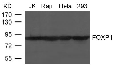 Polyclonal Antibody to FOXP1