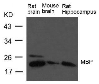 Polyclonal Antibody to MBP (myelin basic protein)