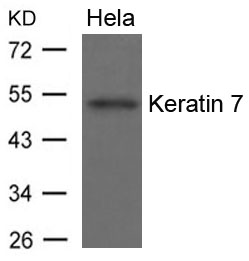 Polyclonal Antibody to Keratin 7