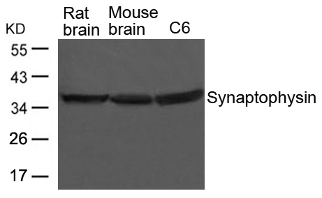 Polyclonal Antibody to Synaptophysin