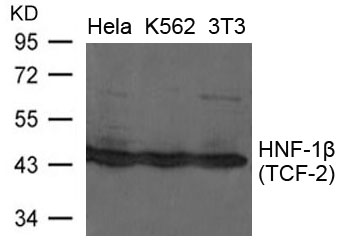 Polyclonal Antibody to HNF-1beta(TCF-2) 