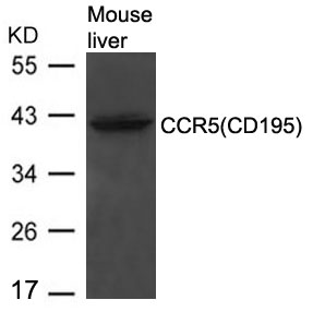 Polyclonal Antibody to CCR5(CD195)