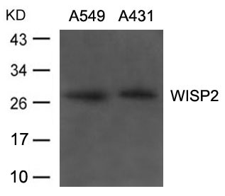 Polyclonal Antibody to WISP2