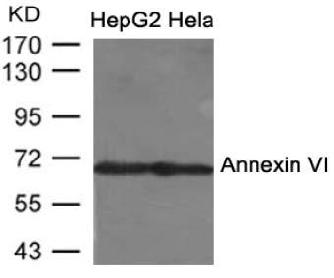 Polyclonal Antibody to Annexin VI Antibody