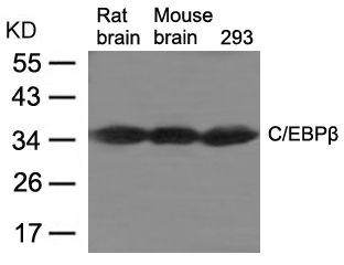 Polyclonal Antibody to C/EBPbeta