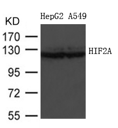 Polyclonal Antibody to HIF2A