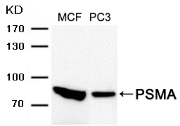 Polyclonal Antibody to PSMA