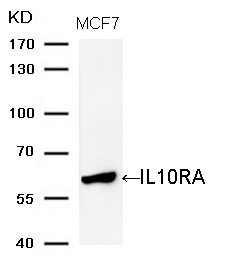 Polyclonal Antibody to IL10RA (Ab-370)