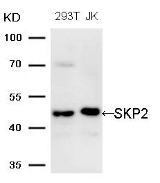 Polyclonal Antibody to SKP2 (Ab-64)