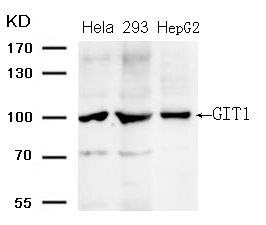 Polyclonal Antibody to GIT1 (Ab-383)